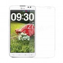 LG L70 (D325) - Защитная пленка